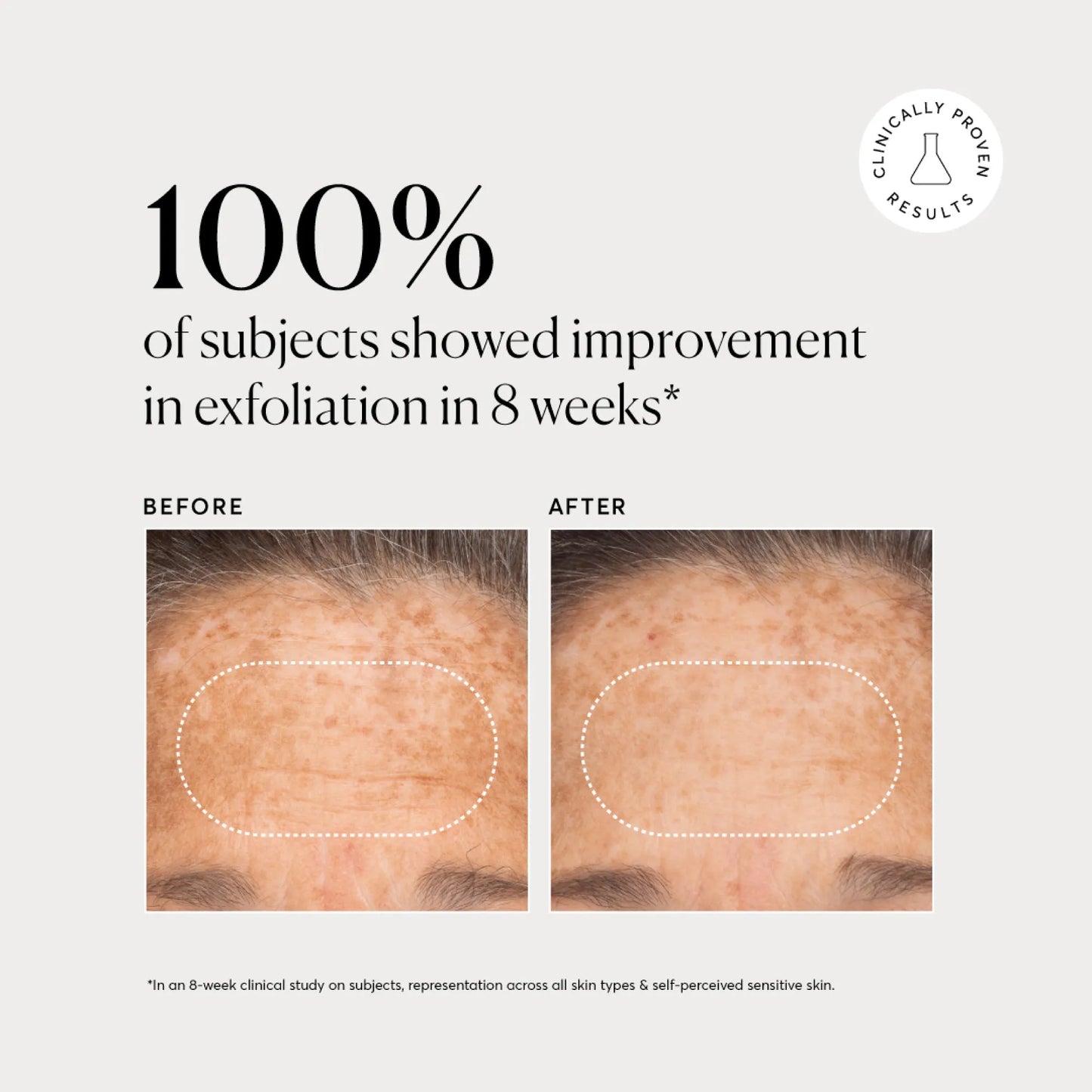 bha-liquid-exfoliant-2-v1 NATR-10027-Alt-Images-BHA-Liquid-Exfoliant-2_-03.webp